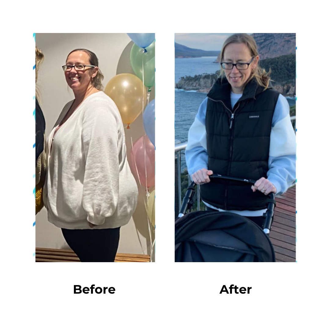 Donna lost 83 kg after weight loss surgery